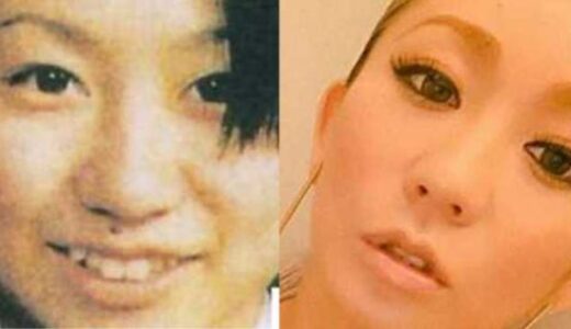 整形前の方が美人だった女性芸能人ランキングTOP20！